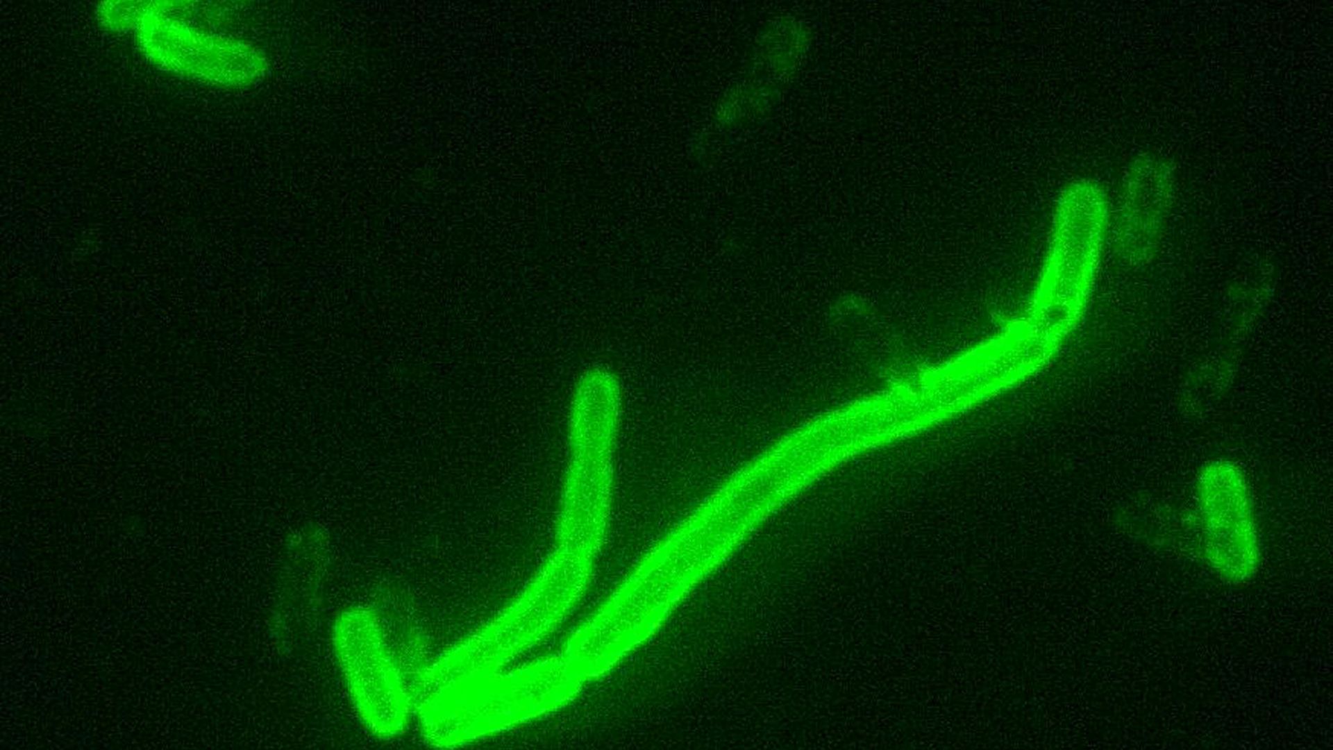 File:Yersinia pestis fluorescent.jpeg