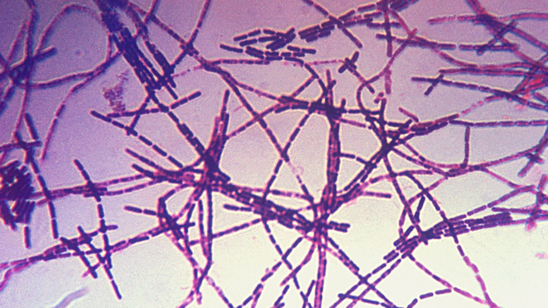 File:Bacillus anthracis Gram.jpg
