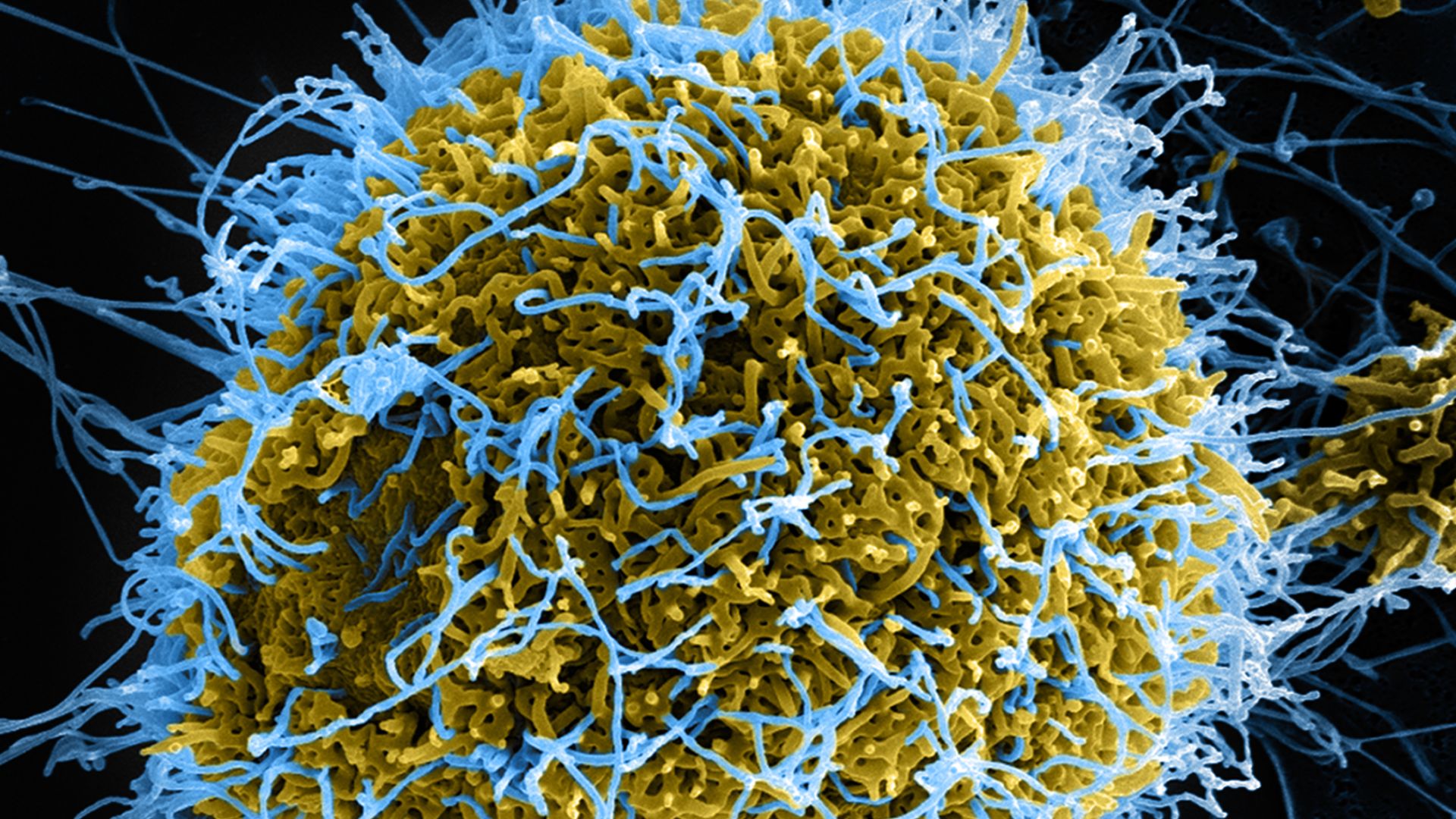 File:Ebola Virus Particles (7).jpg