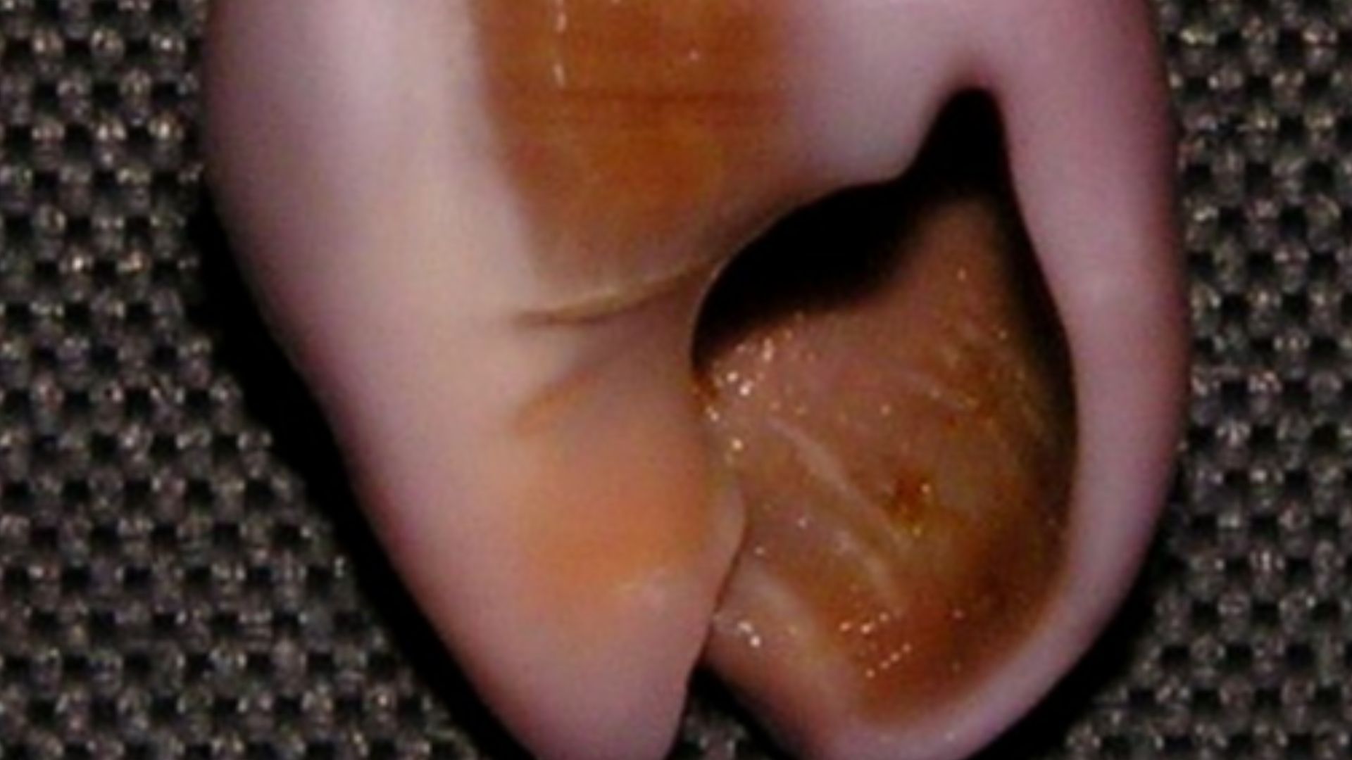 File:Nassarius gibbosulus 002.jpg