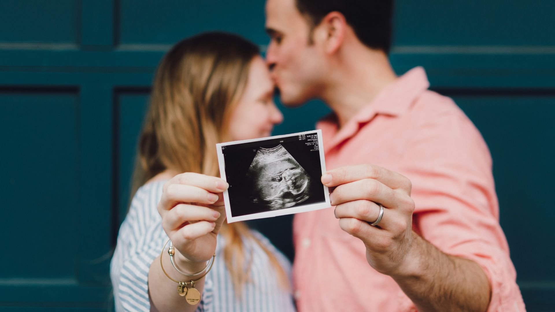 man kissing woman's forehead white holding ultrasound photo