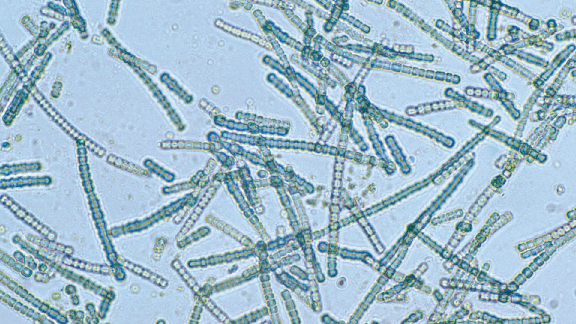 File:CSIRO ScienceImage 4203 A bluegreen algae species Cylindrospermum sp under magnification.jpg