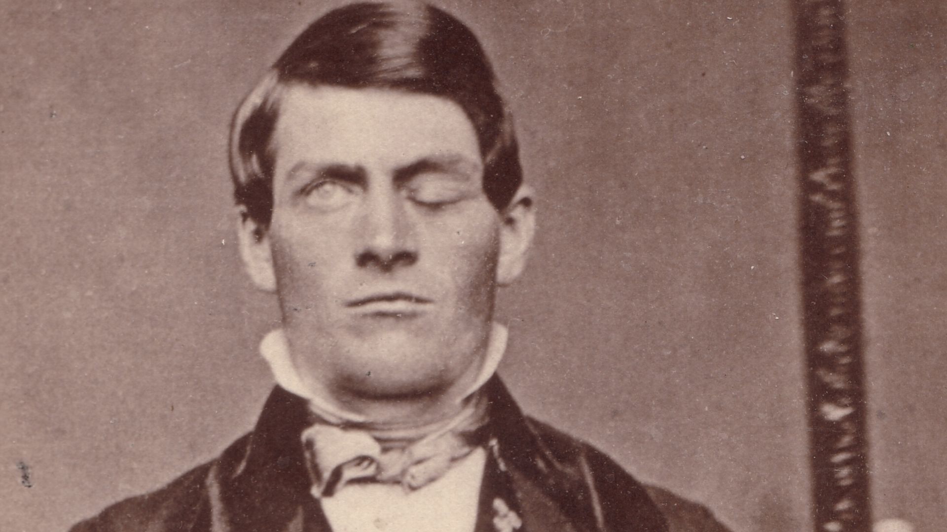 File:Phineas Gage GageMillerPhoto2010-02-17 Unretouched Color Cropped.jpg