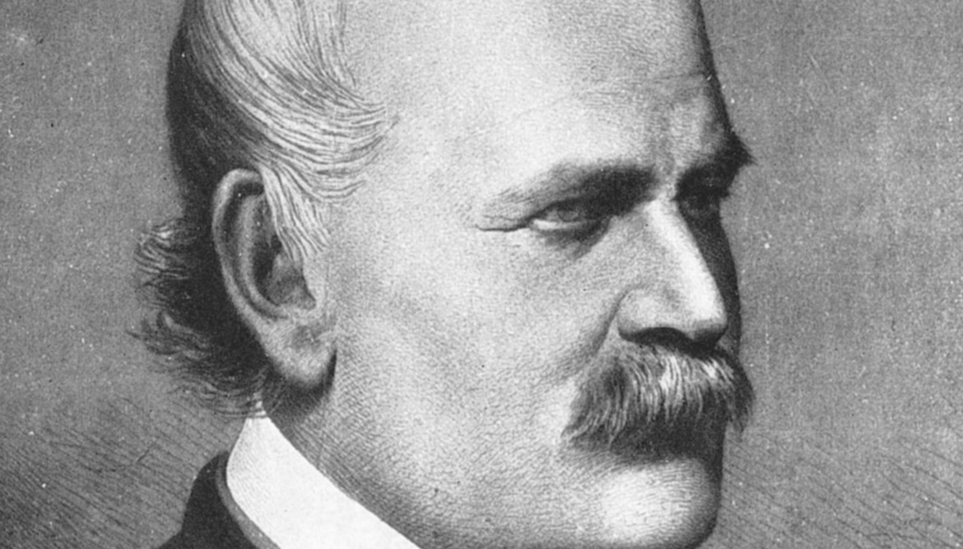 File:Ignaz Semmelweis 1860.jpg