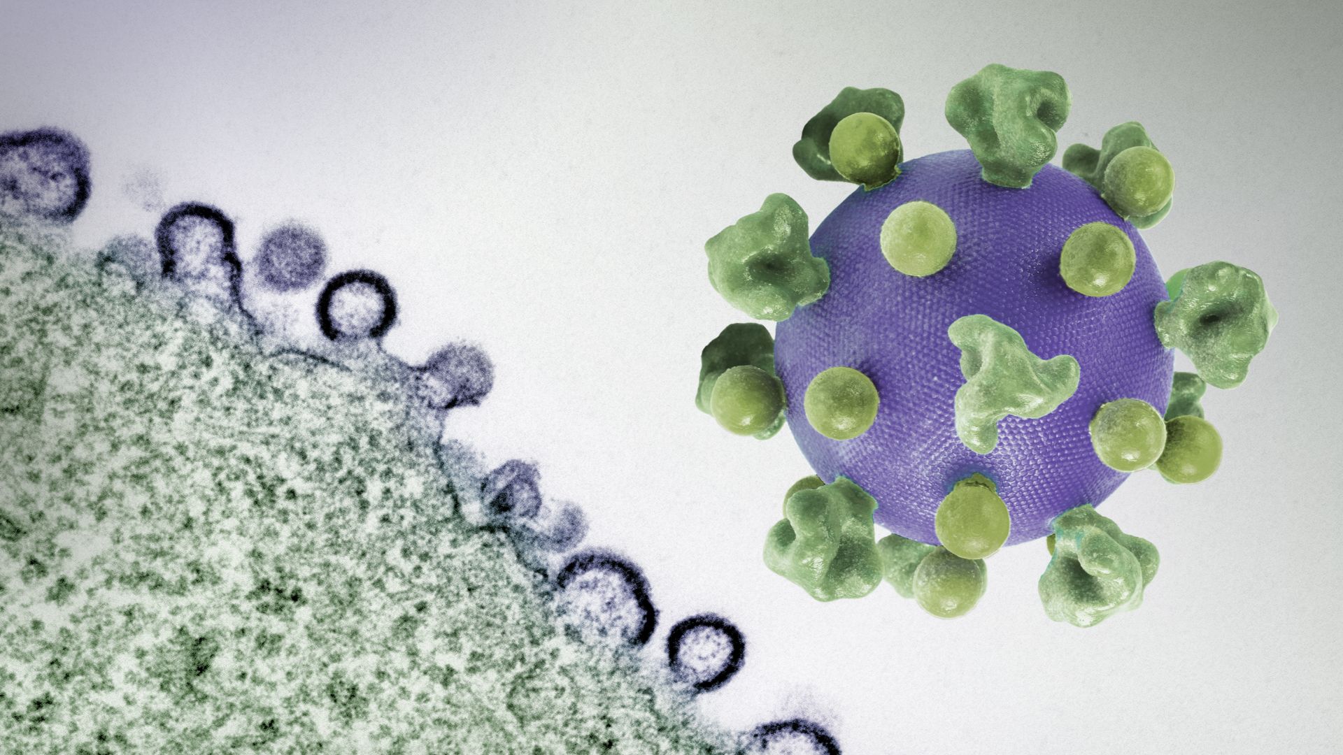 File:HIV Virus - 2.jpg