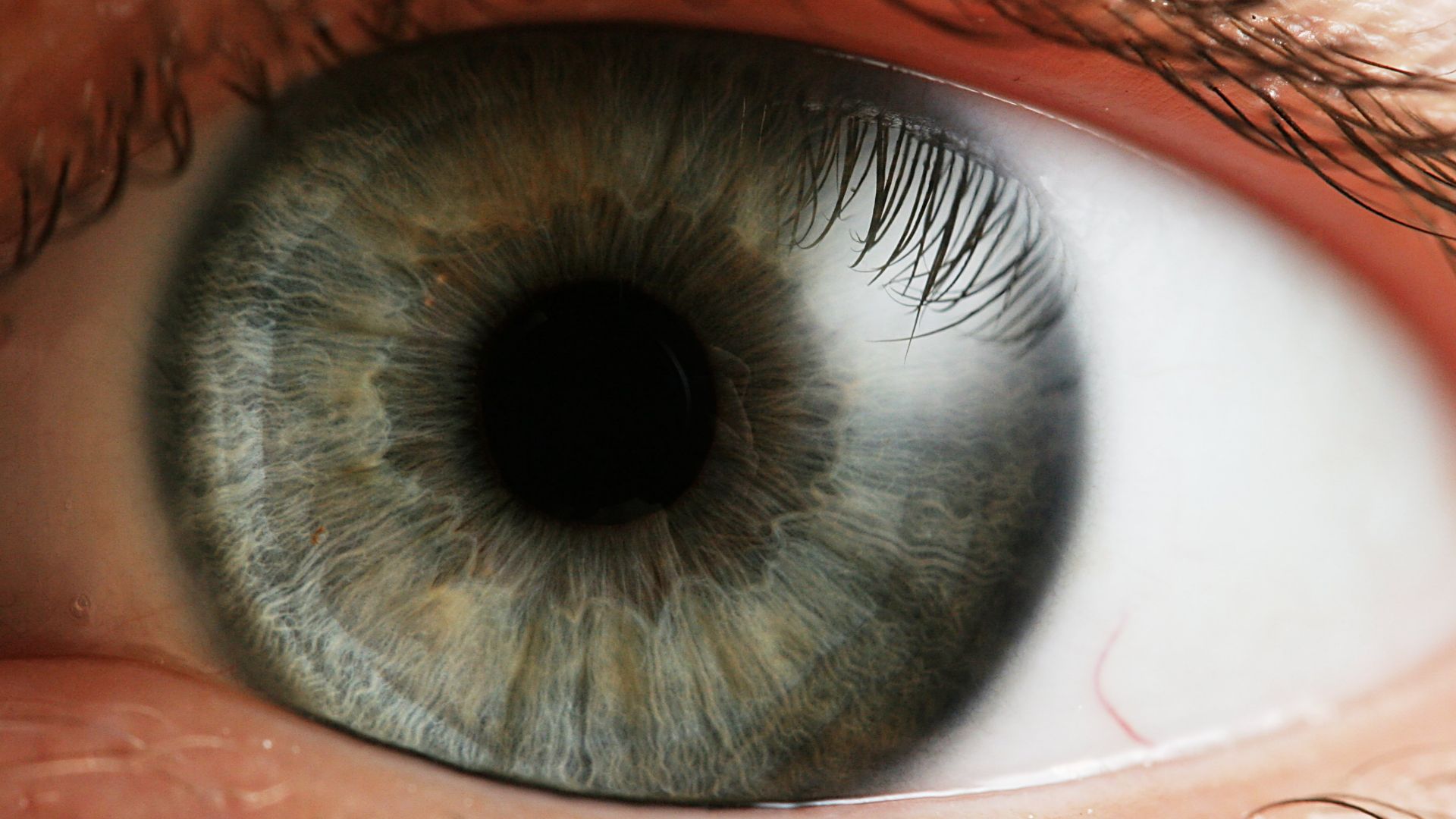 File:Eye iris.jpg