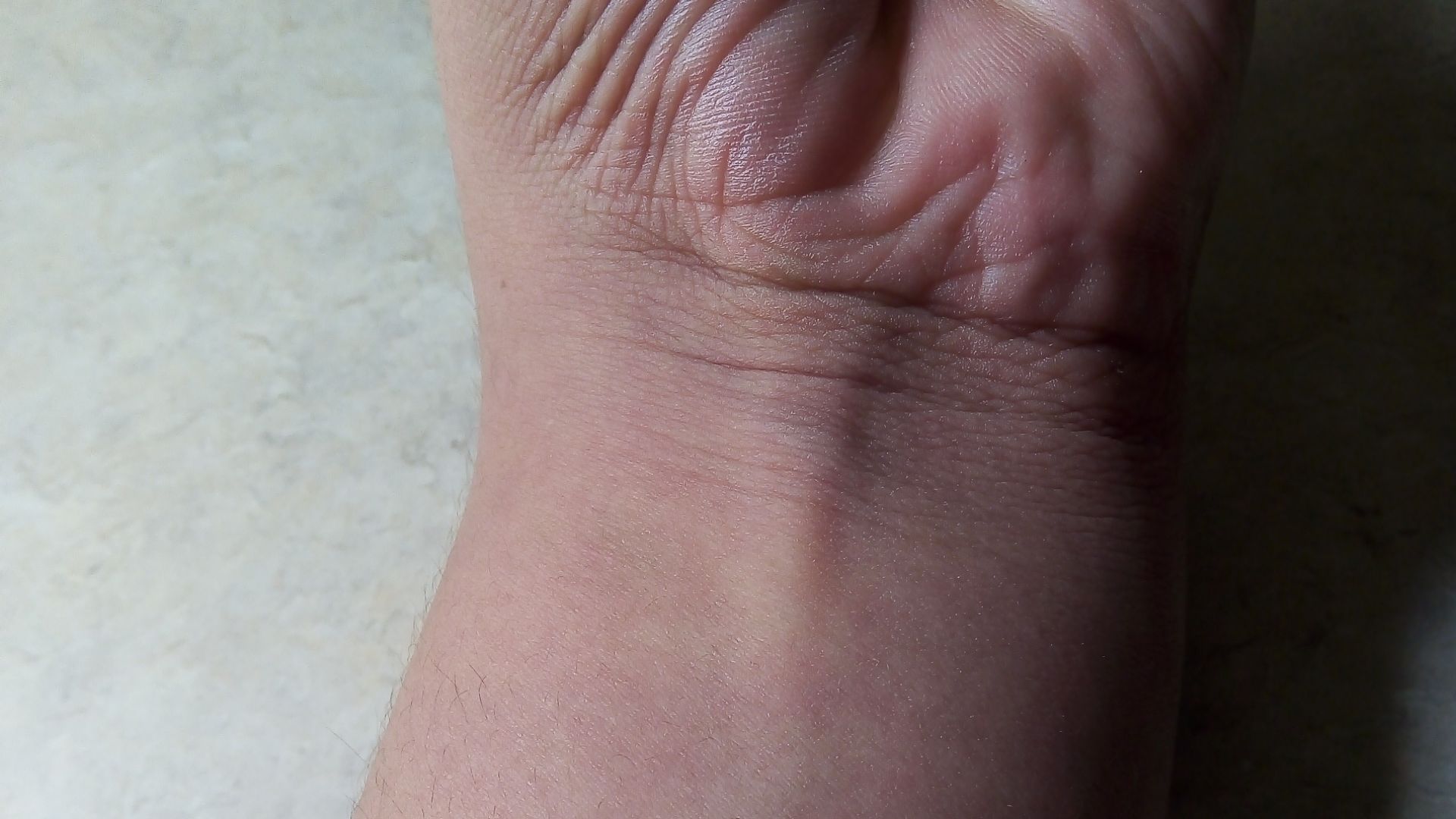 File:Palmaris longus.jpg