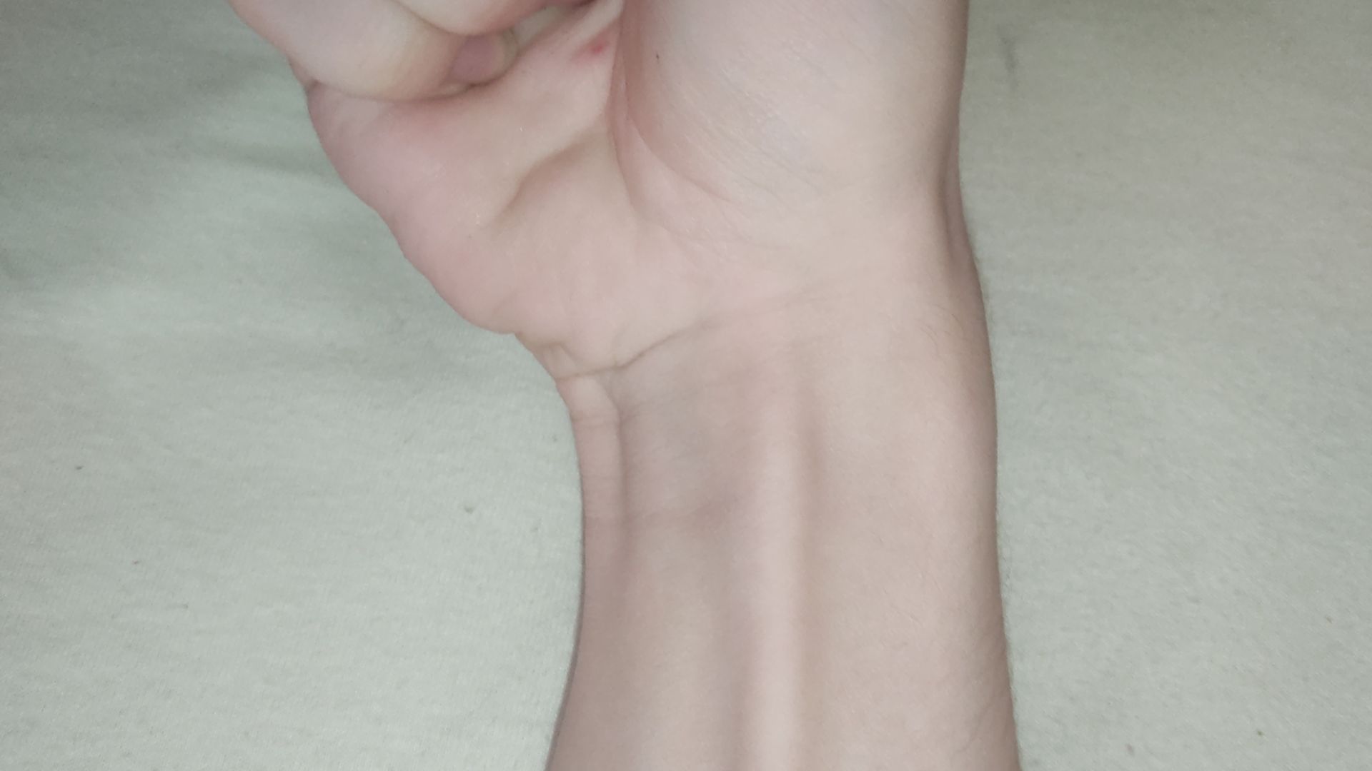 File:Palmaris longus tendon.jpg