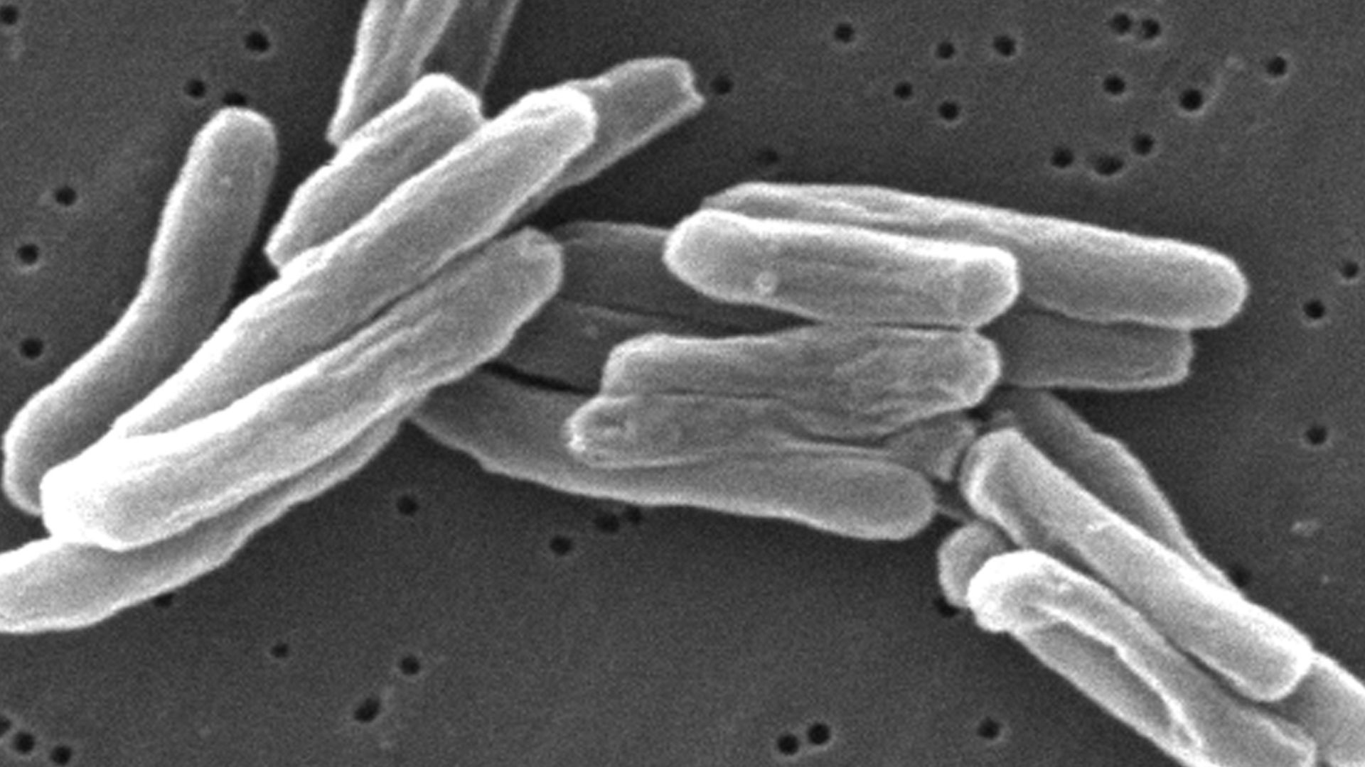 File:Mycobacterium tuberculosis.jpg