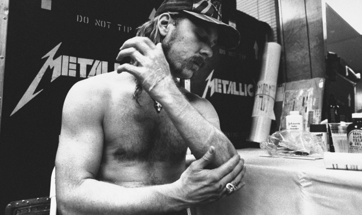 James Hetfield, lead singer and rhythm guitarist for the rock group Metallica, rubbing aloe on burns on his arm inflicted when he strayed into the path of 12-foot-high special-effects flames during Montreal concert, in dressing room, backstage at Oakland.Coliseum