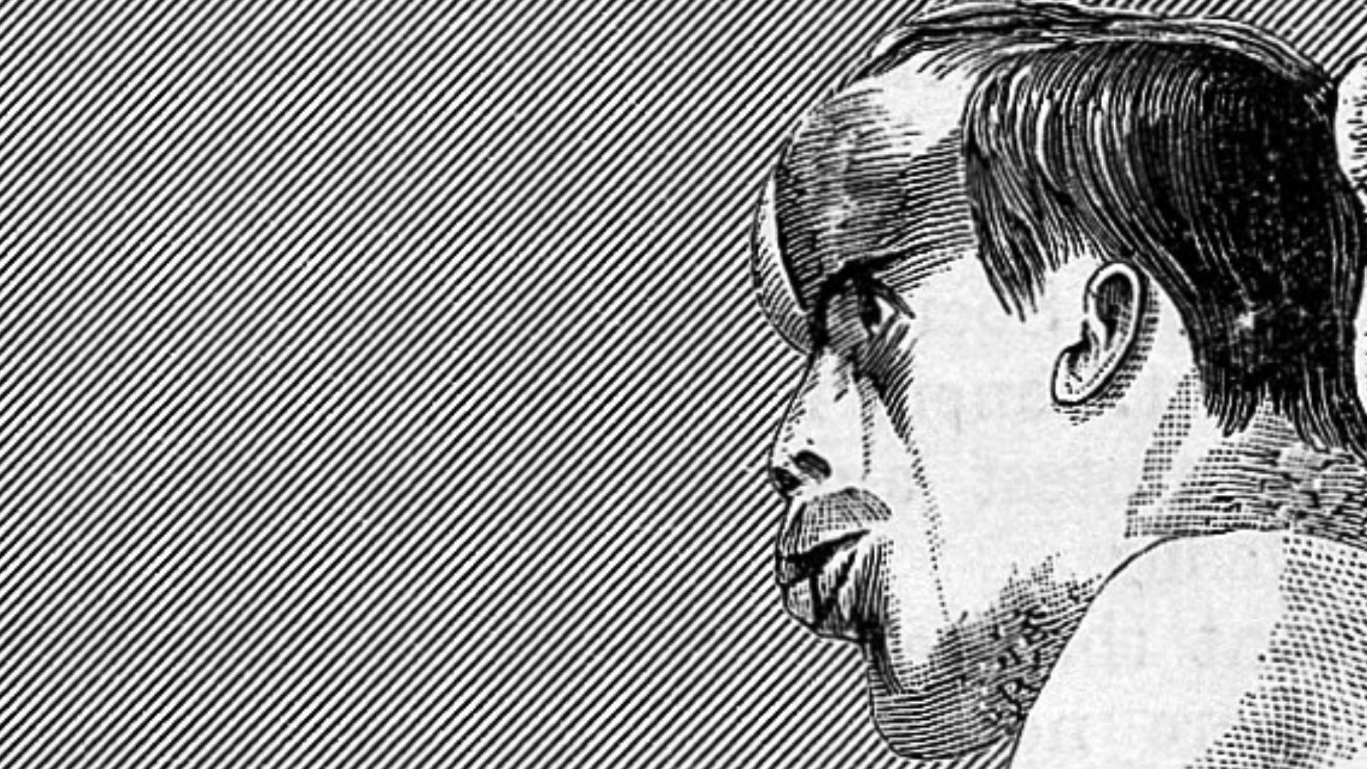 File:Joseph Carey Merrick Wellcome L0026216.jpg