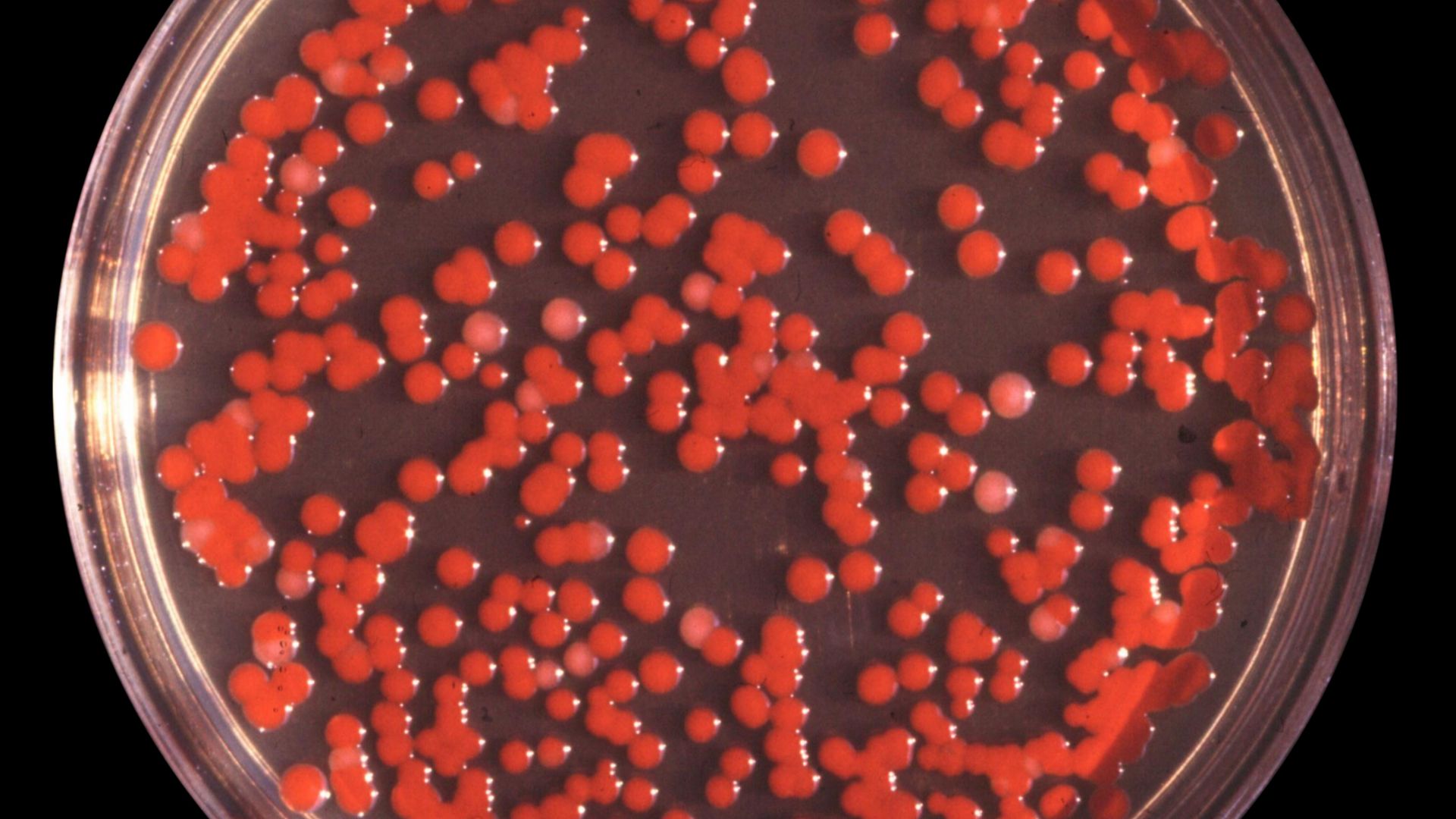 File:Serratia marcescens.jpg