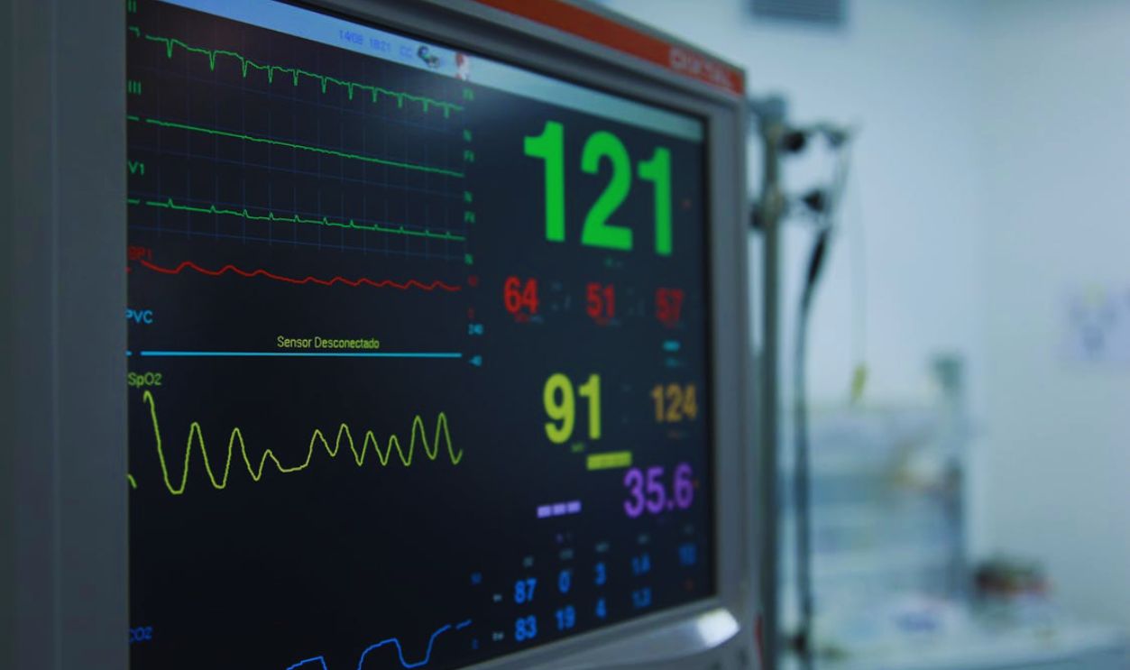 Vital Signs Monitor in Close-up Photography