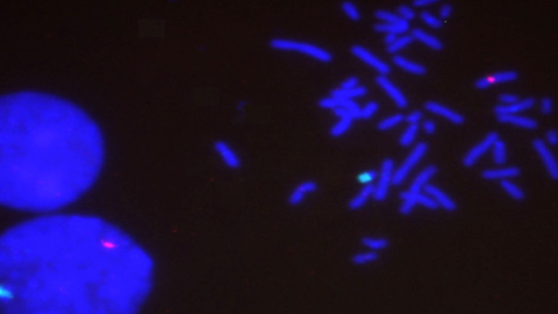 Results of in situ hybridization of chromosome X and Y BAC probes. (A) Dual color hybridization showing highly specific signals on the X (red) and Y (green) chromosomes in metaphase cells. The two diploid interphase cell nuclei from a normal male donor show the expected pair of single signals. (B) The approximate locations of the hybridization targets shown along ideograms of the human X and Y chromosomes.
