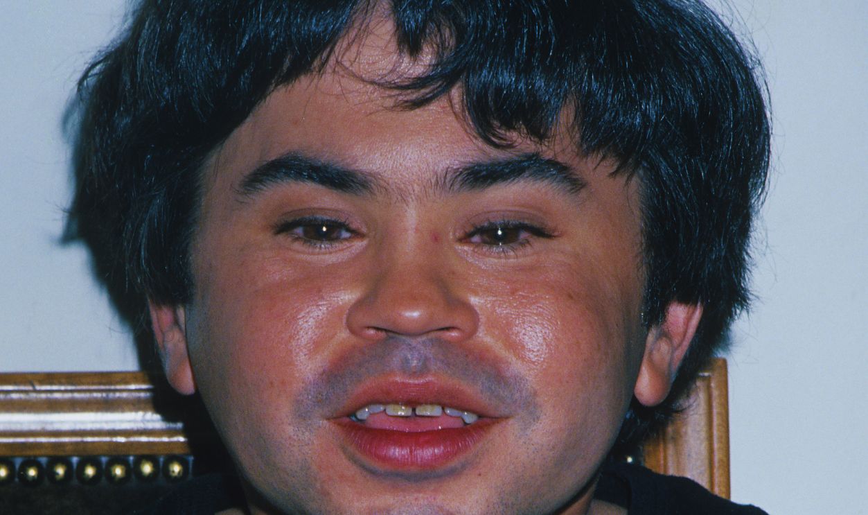 Gettyimages - 135871101, Herve Villechaize