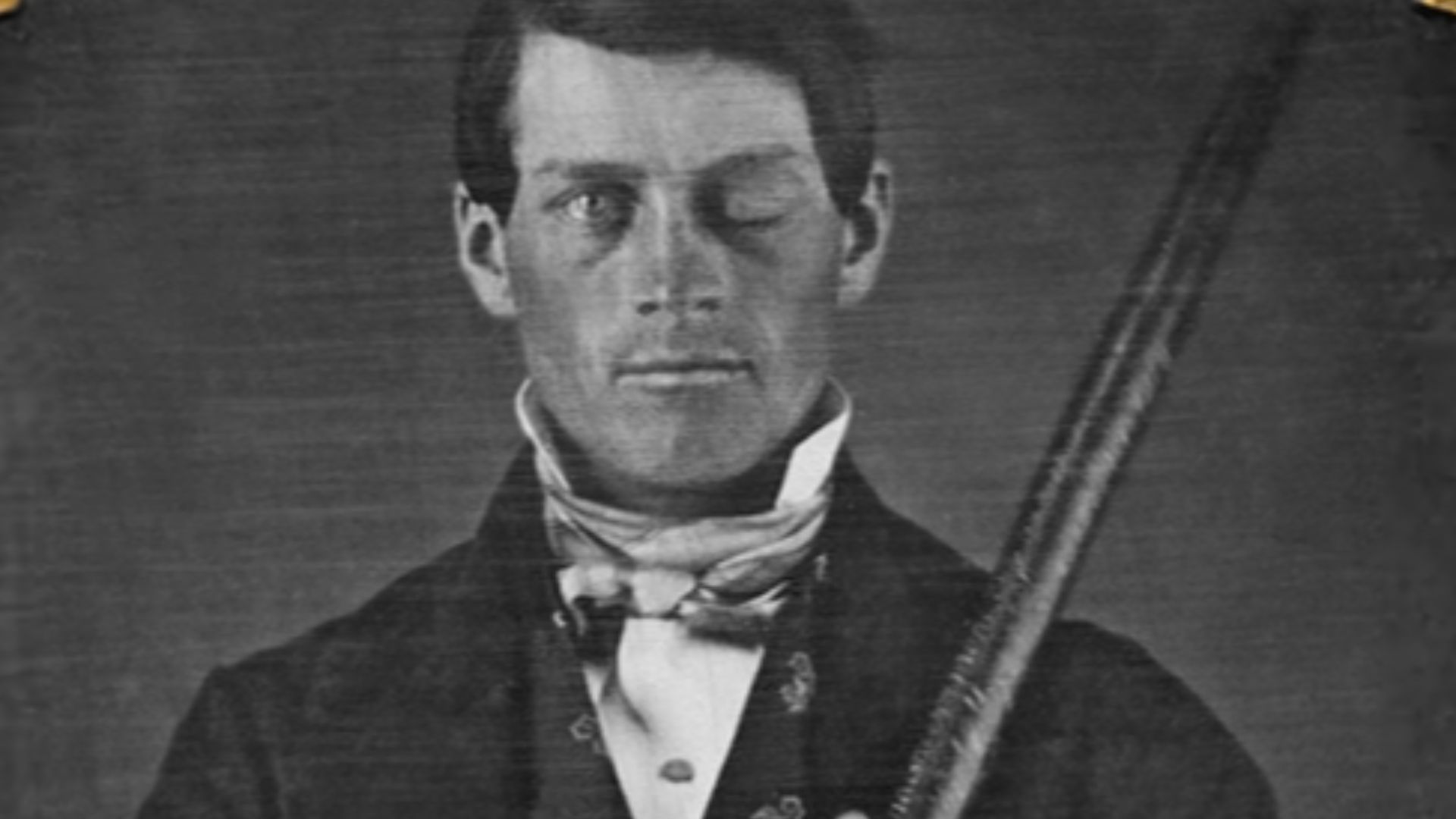 Photograph of cased-daguerreotype studio portrait of brain-injury survivor Phineas P. Gage (1823–1860) shown holding the tamping iron which injured him. Includes view of original embossed brass mat. From the collection of Jack and Beverly Wilgus. Like mos