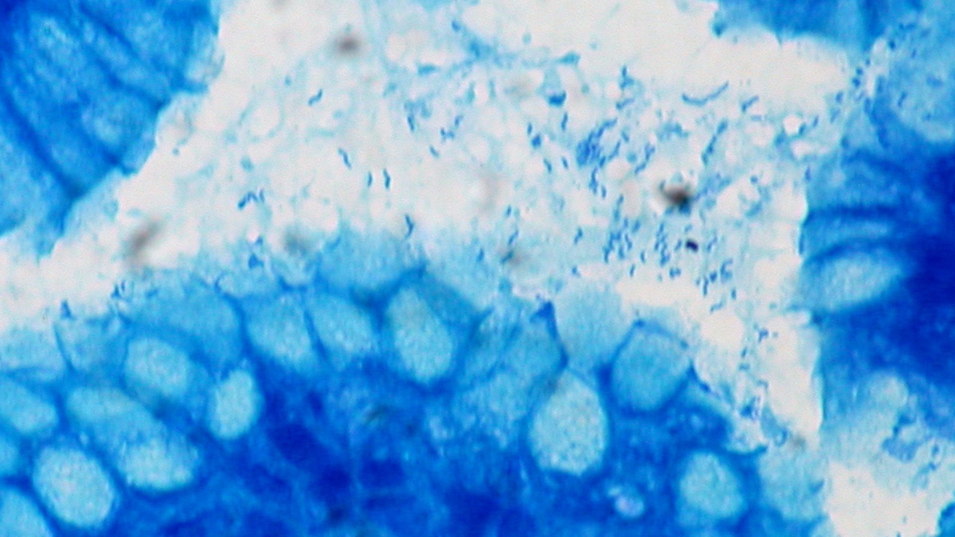 Helicobacter pylori, Gastric Biopsy, Giemsa Stain

Pathological and histological images courtesy of Ed Uthman at flickr.