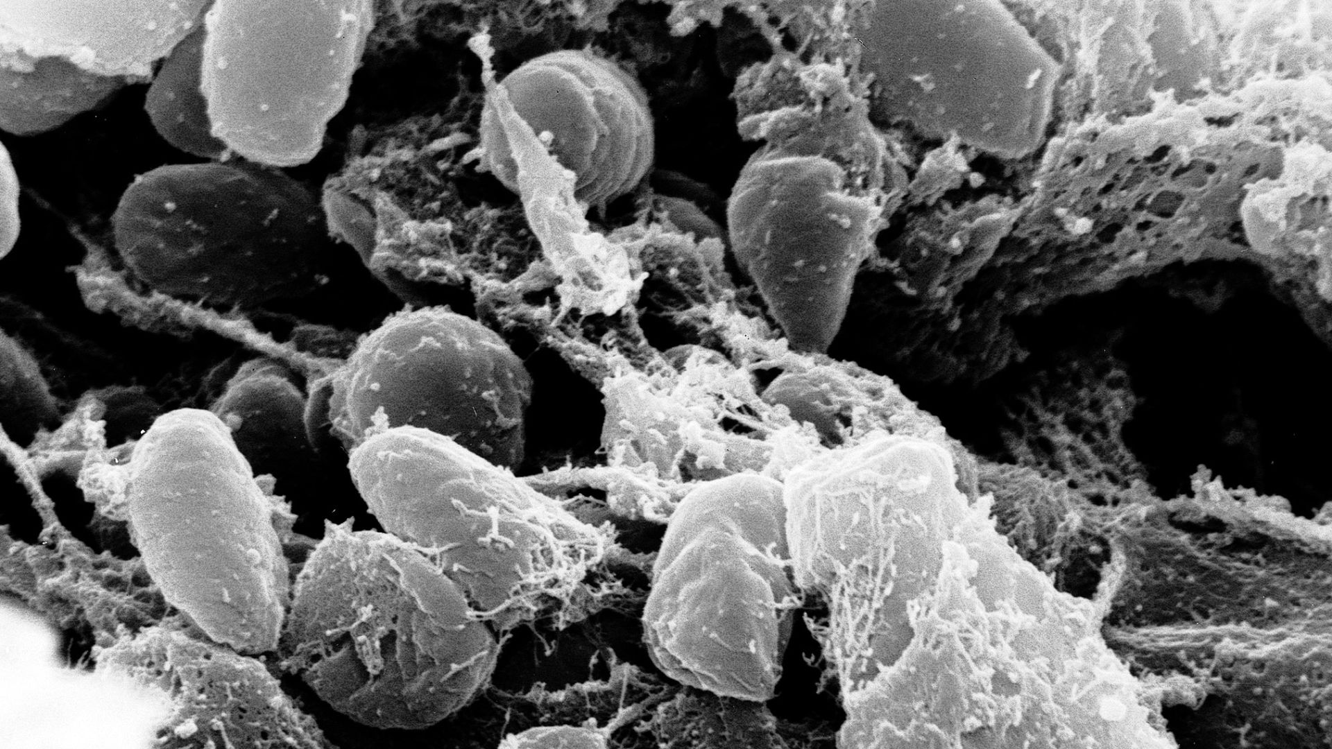 File:Yersinia pestis.jpg