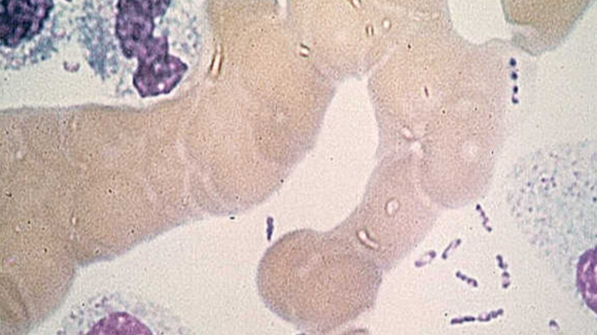 Wayson stain of Yersinia pestis. Note the characteristic