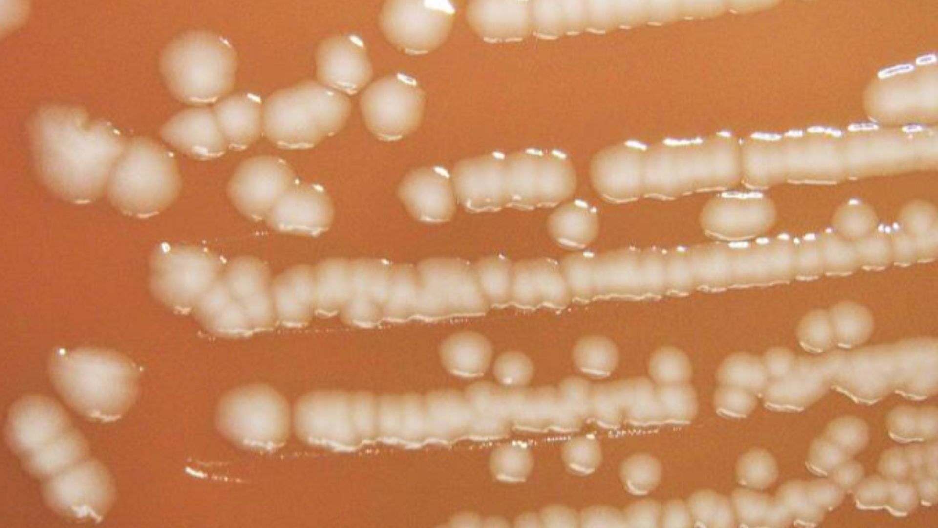 Yersinia pseudotuberculosis bacteria, image