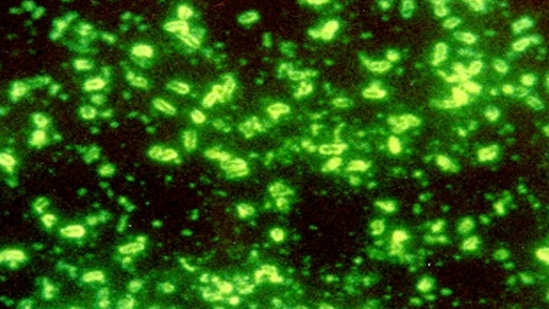 Yersinia pestis