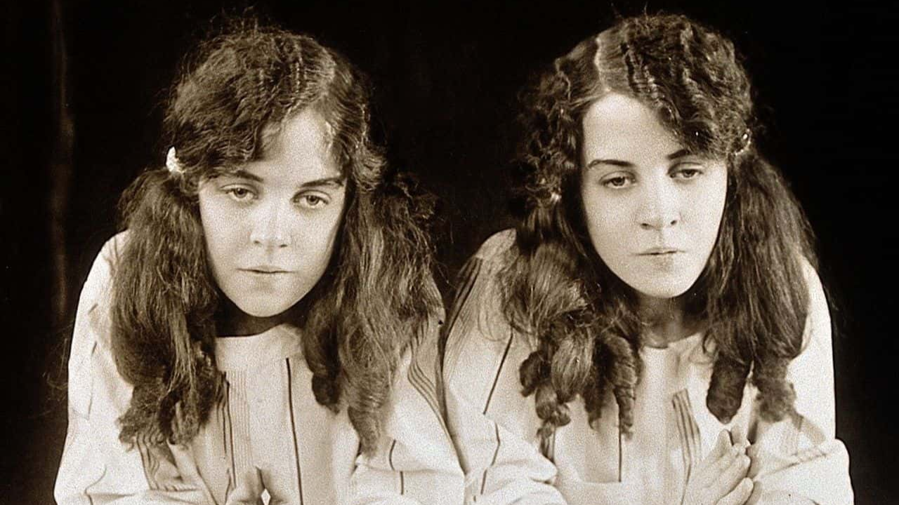 Daisy and Violet Hilton facts