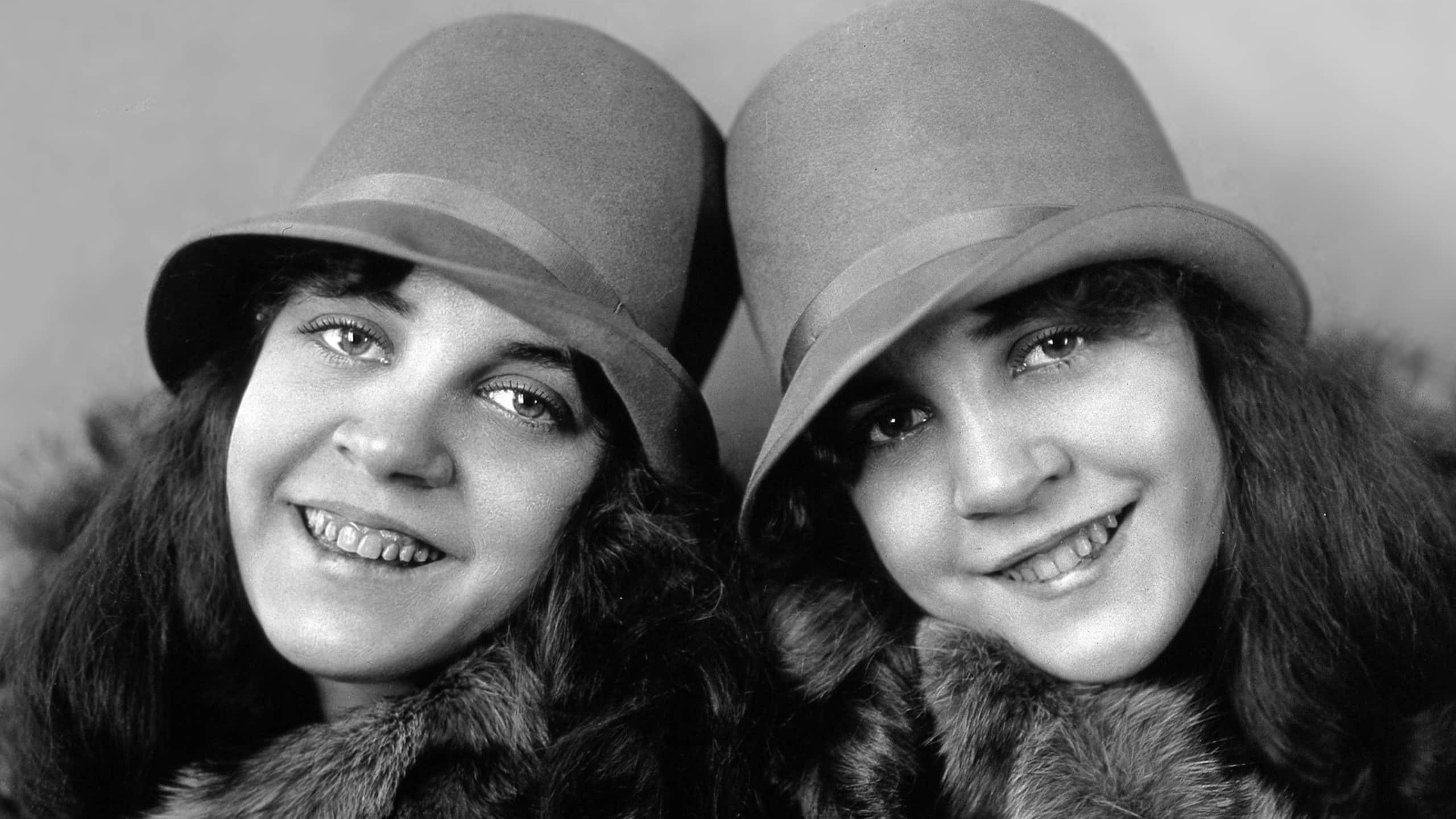 Daisy and Violet Hilton facts