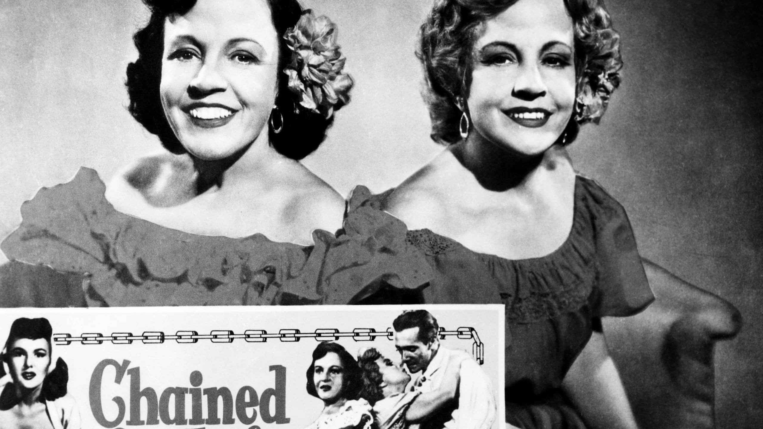Daisy and Violet Hilton facts