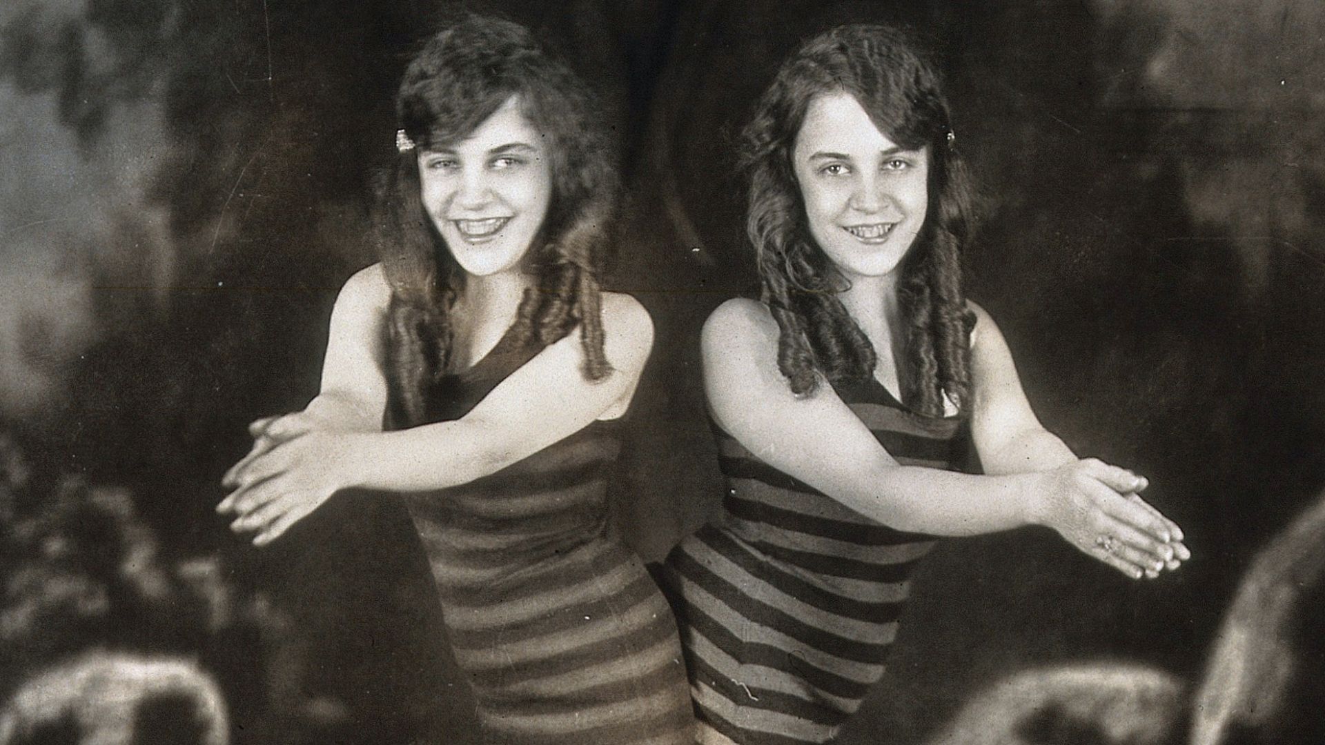 Daisy and Violet Hilton, conjoined twins, wearing swimsuits, posing as though about to dive. Photograph, c. 1927.

Iconographic Collections