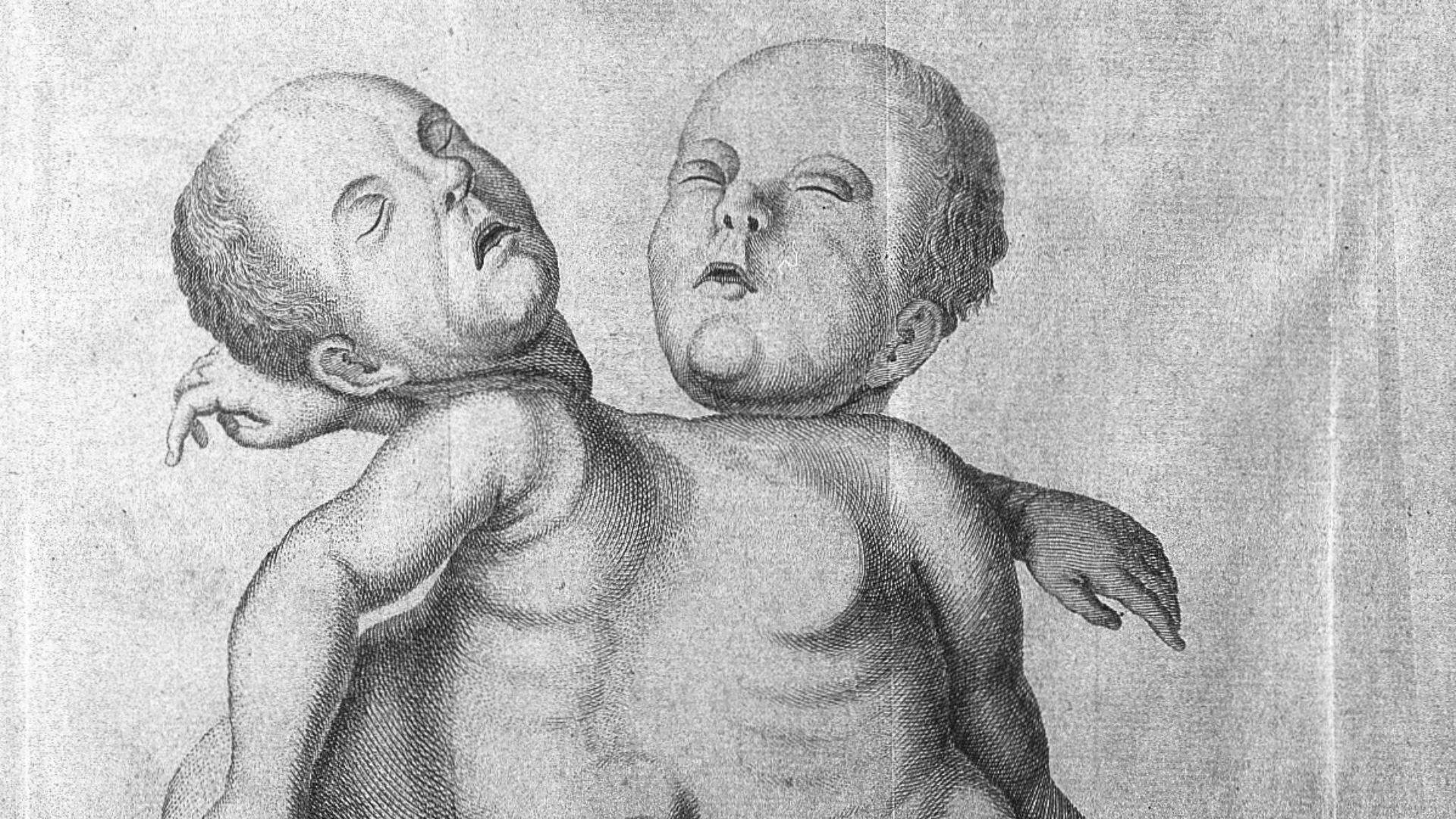 'Puellae absque dissection ad objectum delineatae a parte anteriori.' ('siamese twins').
Rare Books
Keywords: Anatomy