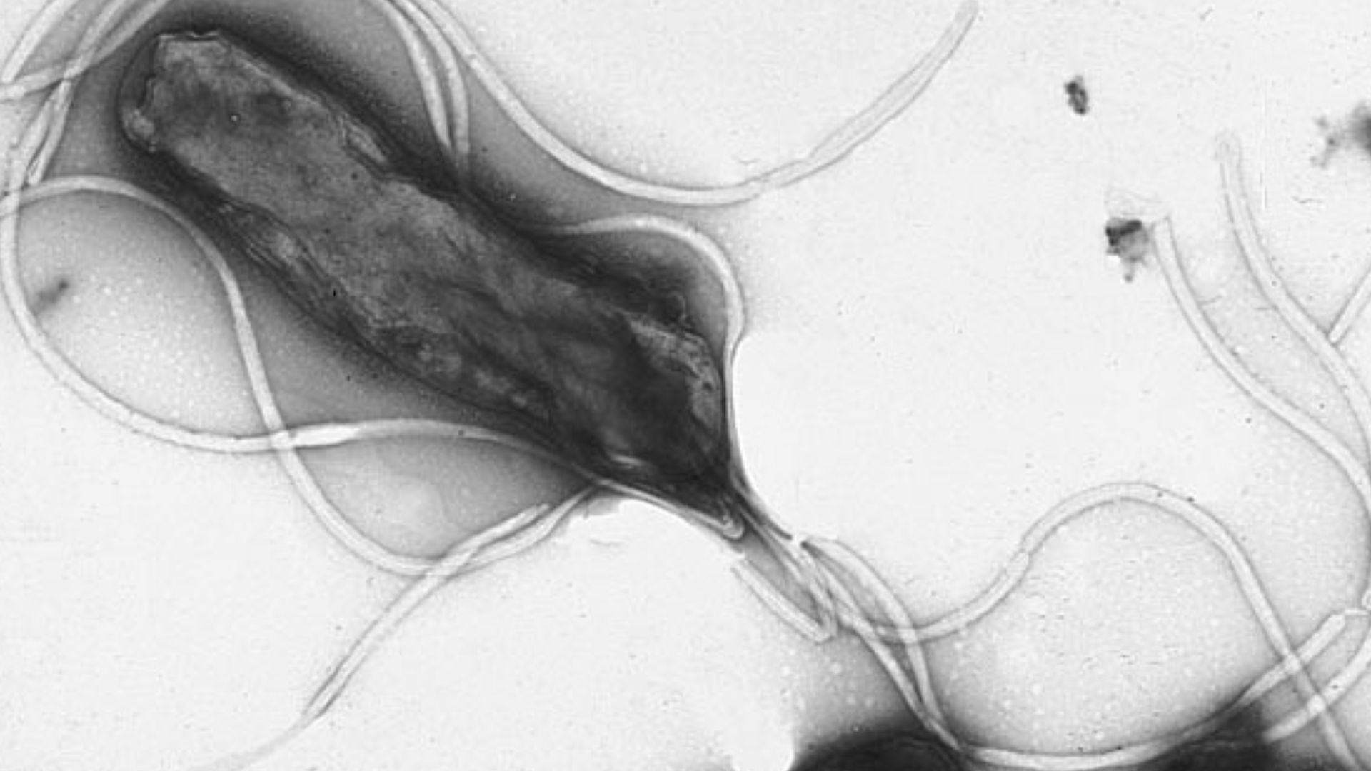 Electron micrograph of H. pylori possessing multiple flagella (negative staining)
