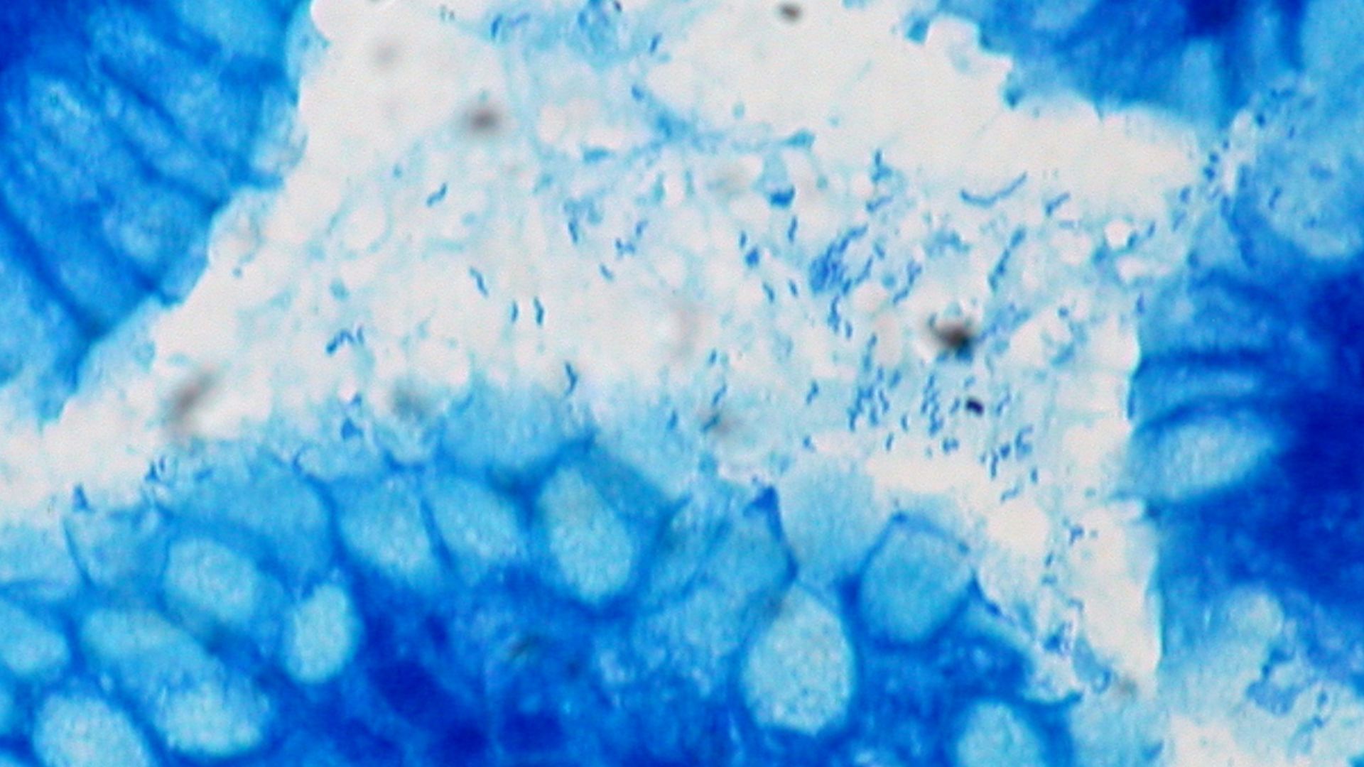 Helicobacter pylori, Gastric Biopsy, Giemsa Stain

Pathological and histological images courtesy of Ed Uthman at flickr.