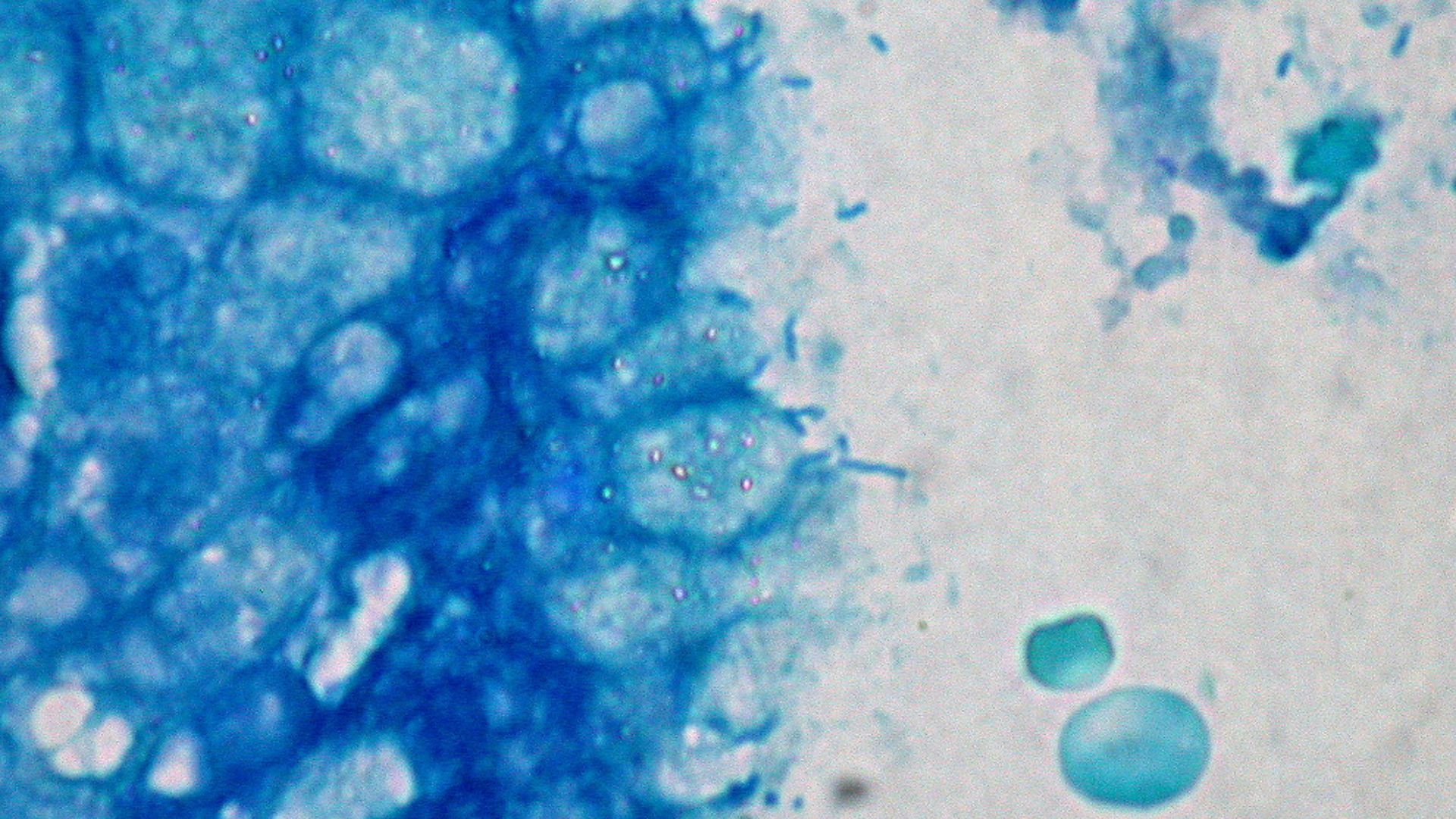 The organisms, scattered on and above the luminal surface, stain more boldly with the Giemsa technique. 1000X.