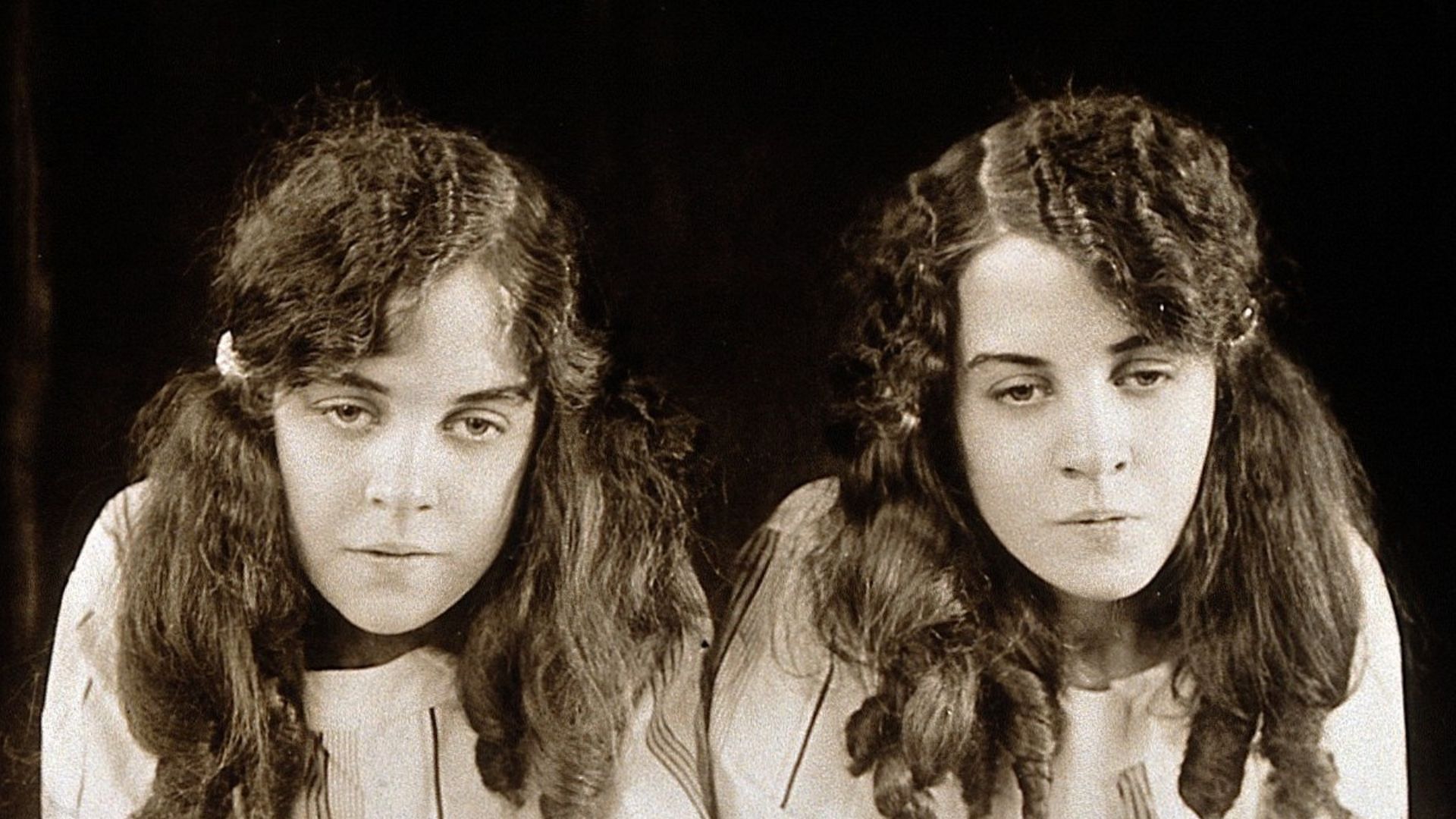 Daisy and Violet Hilton, conjoined twins