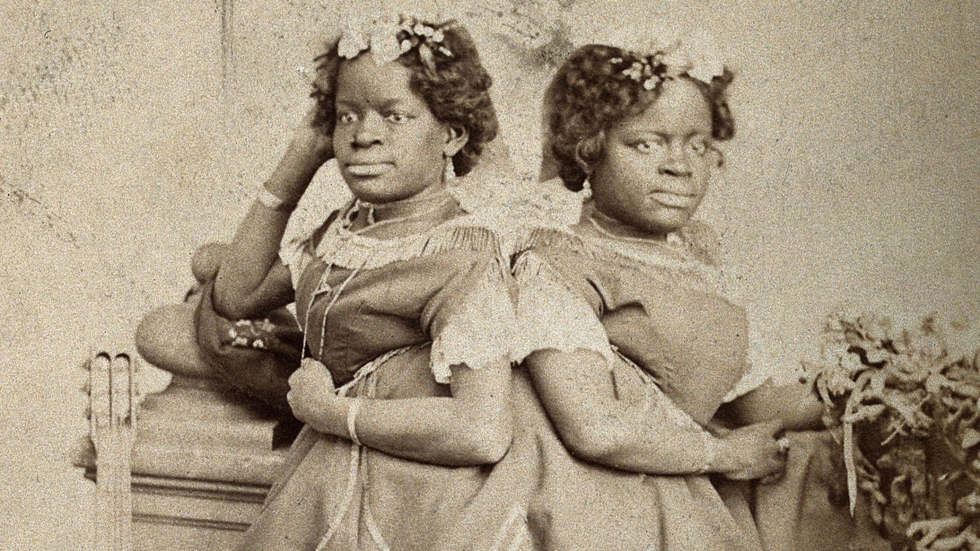 The Millie-Christine sisters, conjoined twins, standing. Photograph, c. 1871.

Iconographic Collections