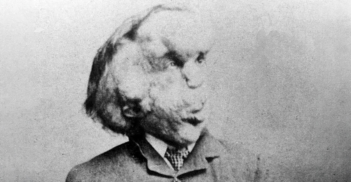 The Elephant Man