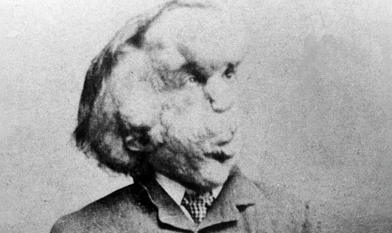 The Elephant Man