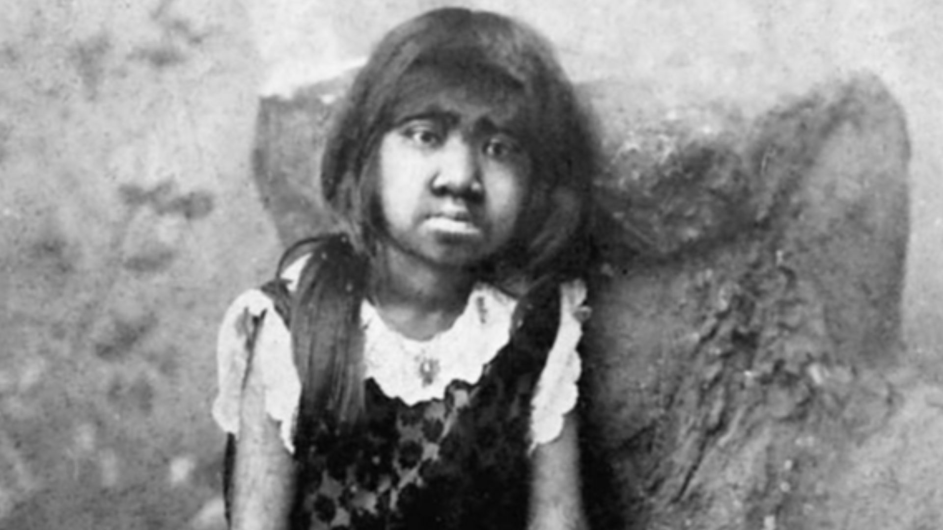 Krao was a girl exhibited in Roy Aquarium in 1883.