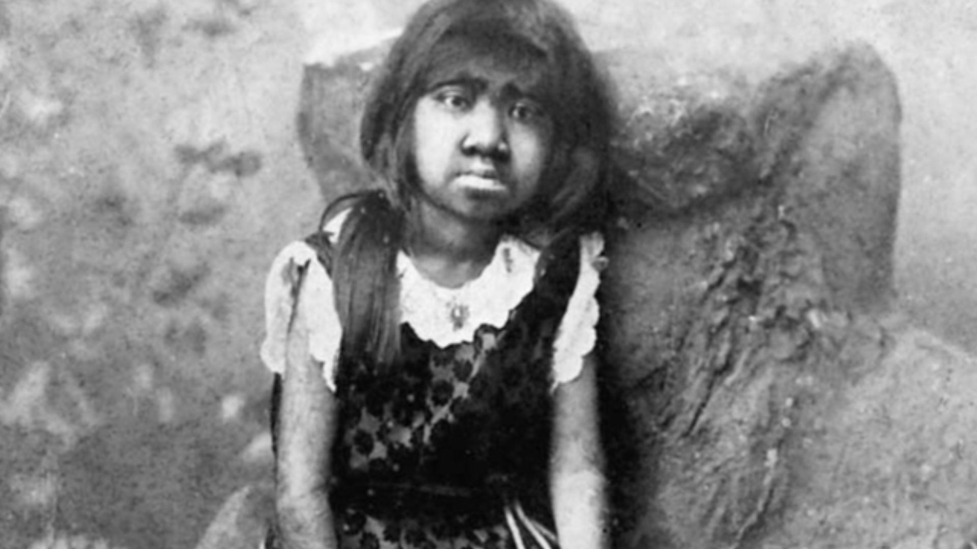 Krao was a girl exhibited in Roy Aquarium in 1883.