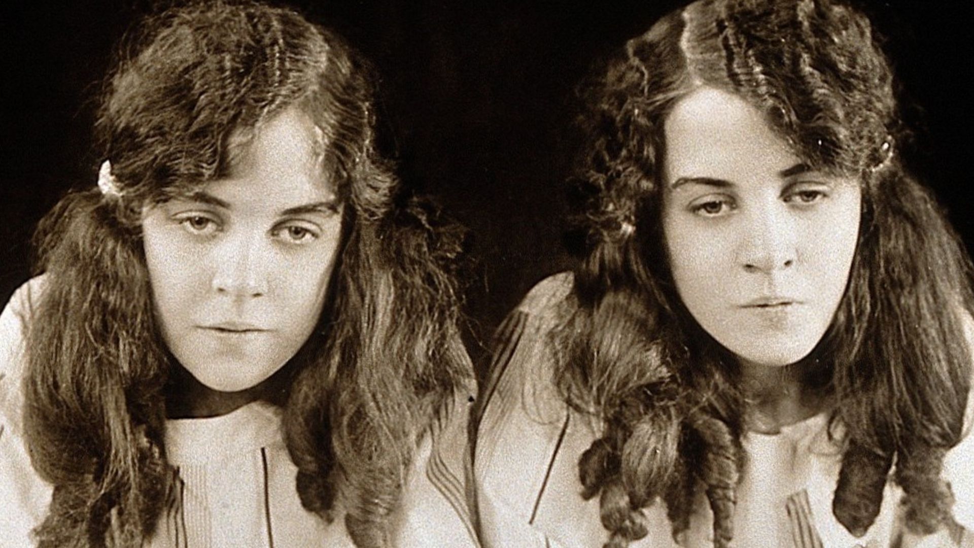 Daisy and Violet Hilton, conjoined twins