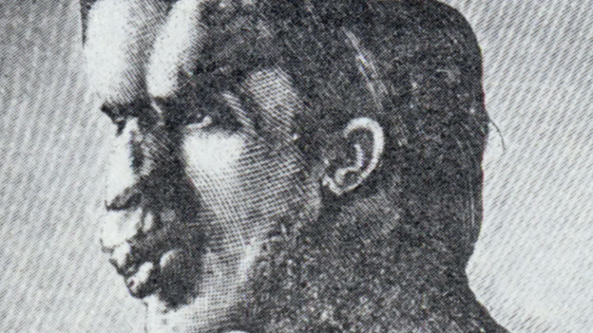 This image of Joseph Merrick (1862–1890) was published in the British Medical Journal in 1886, along with File:Joseph Merrick 1886 2.jpg.