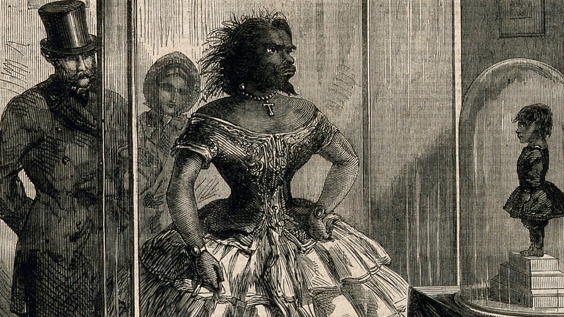 Julia Pastrana, a bearded lady, embalmed. Wood engraving, 1862.
Iconographic Collections
Keywords: portrait prints; Julia Pastrana; Hypertrichosis; wood engravings; pastrana, julia, d. 1860