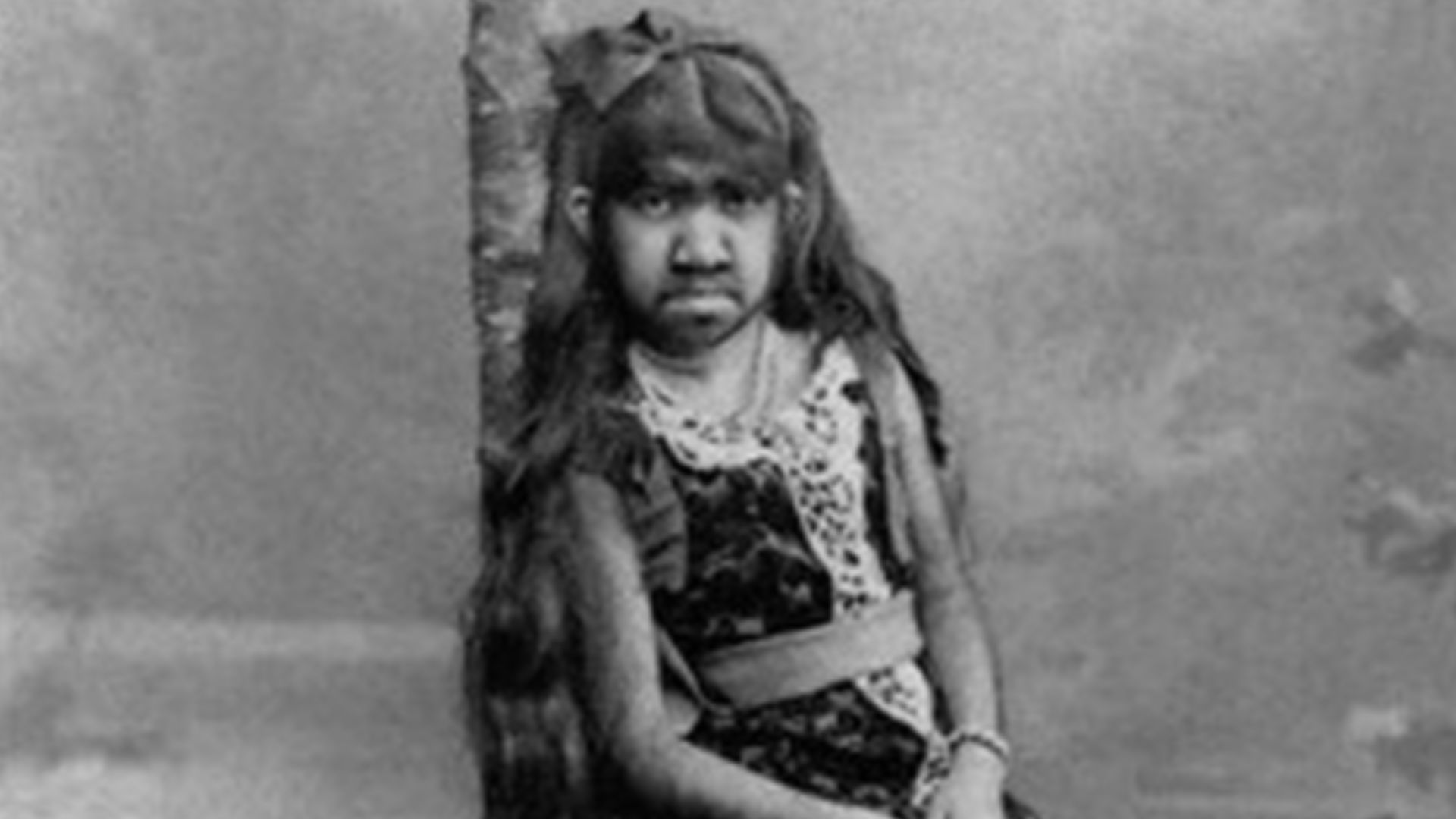 Krao was a girl exhibited in Roy Aquarium in 1883.