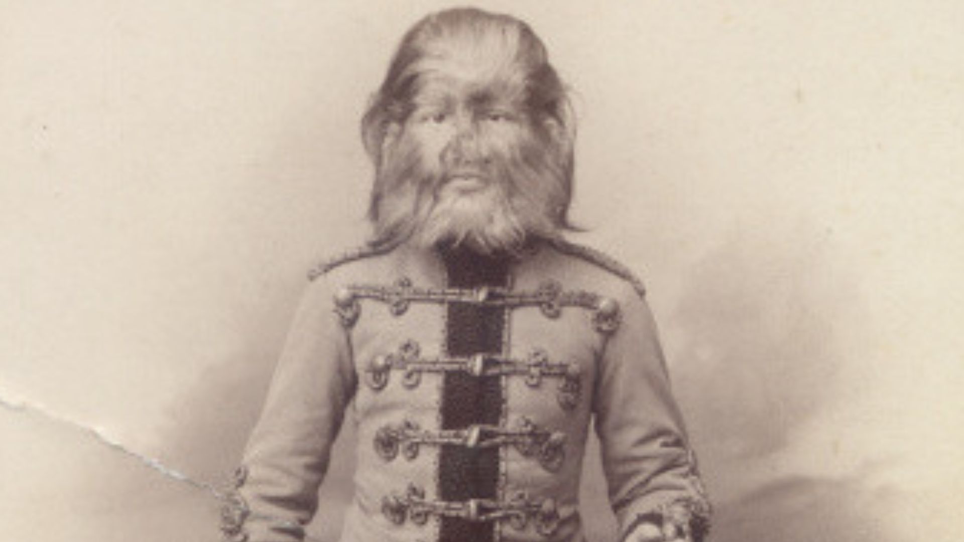Fedor Jeftichew, dit Jo Jo the Dog Faced Boy.