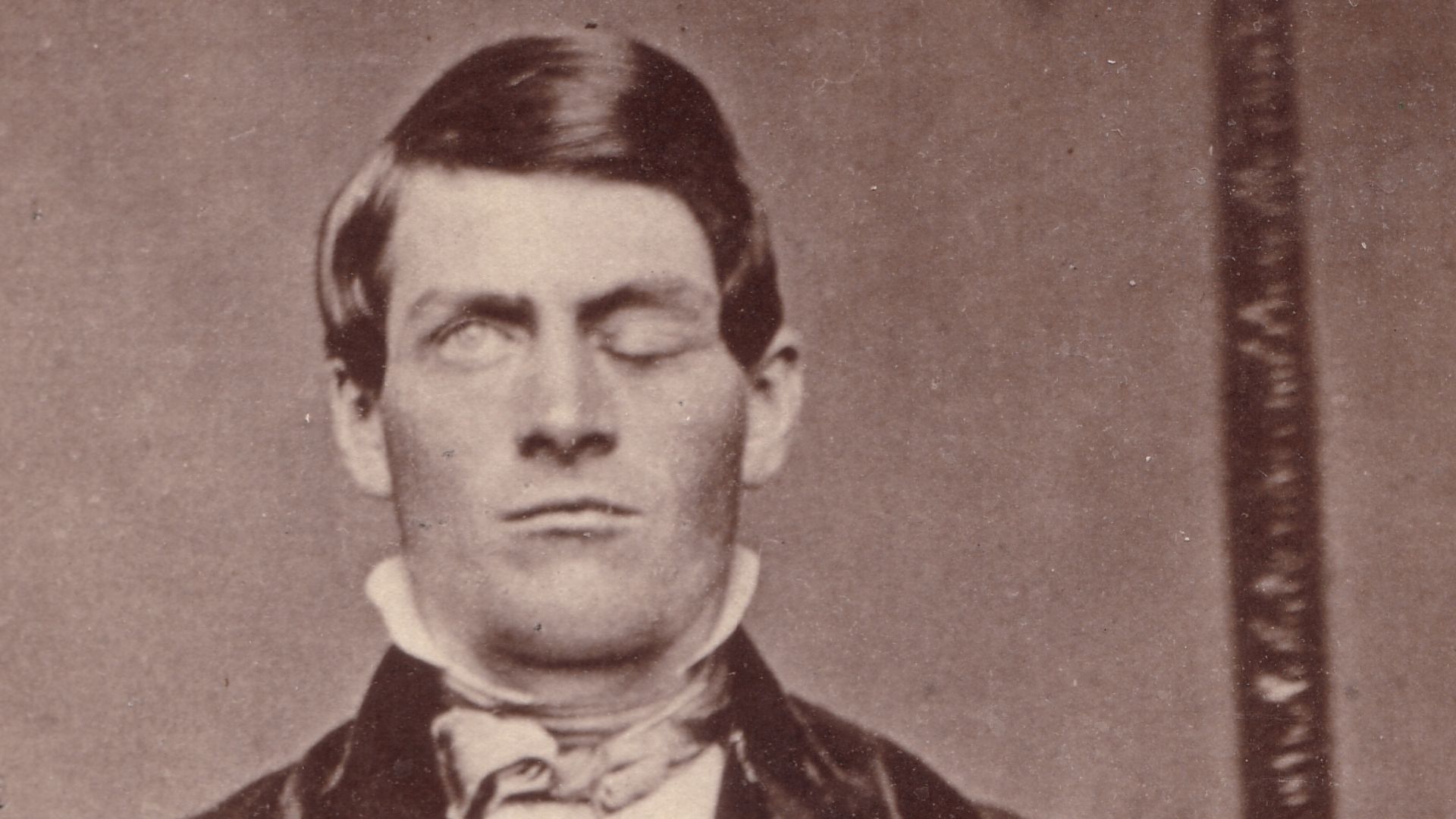 Cabinet-card portrait of brain-injury survivor Phineas P. Gage (1823–1860), shown holding the tamping iron which injured him; image cropped to remove much of surrounding card. From the Gage family of Texas photo collection. An identical image is in the po