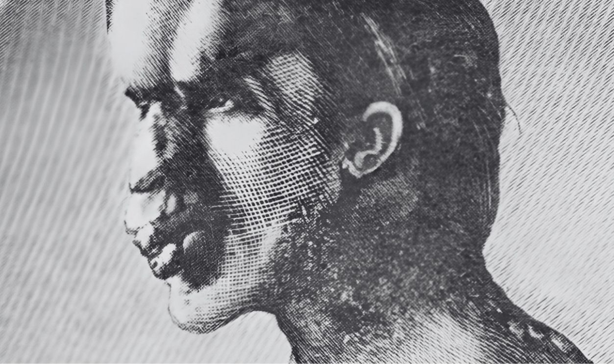 Joseph Merrick