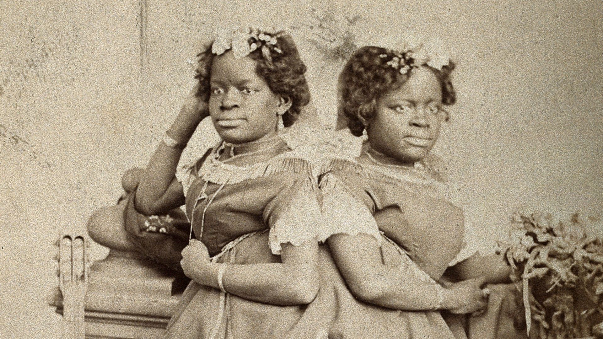 The Millie-Christine sisters, conjoined twins, standing. Photograph, c. 1871.

Iconographic Collections