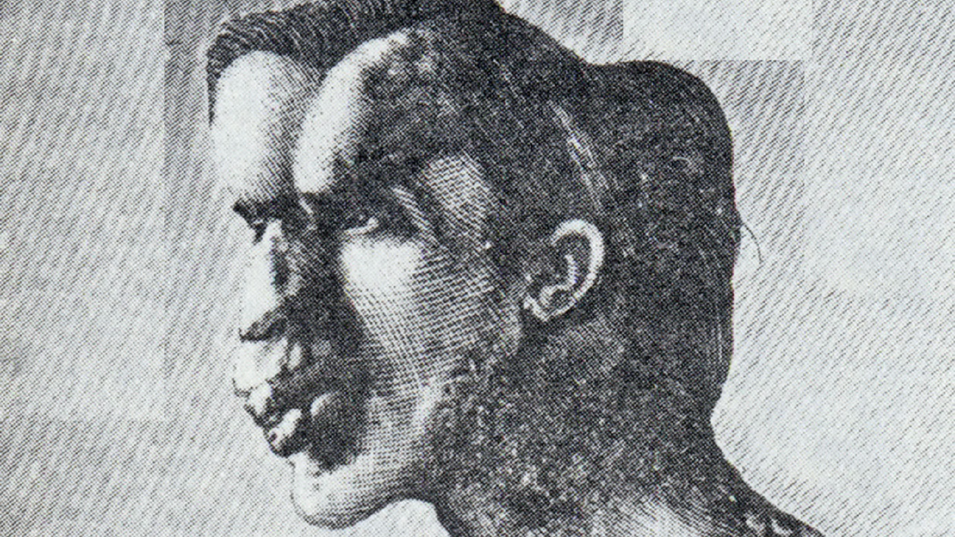 Image of Joseph Merrick, was published in the British Medical Journal - 1886