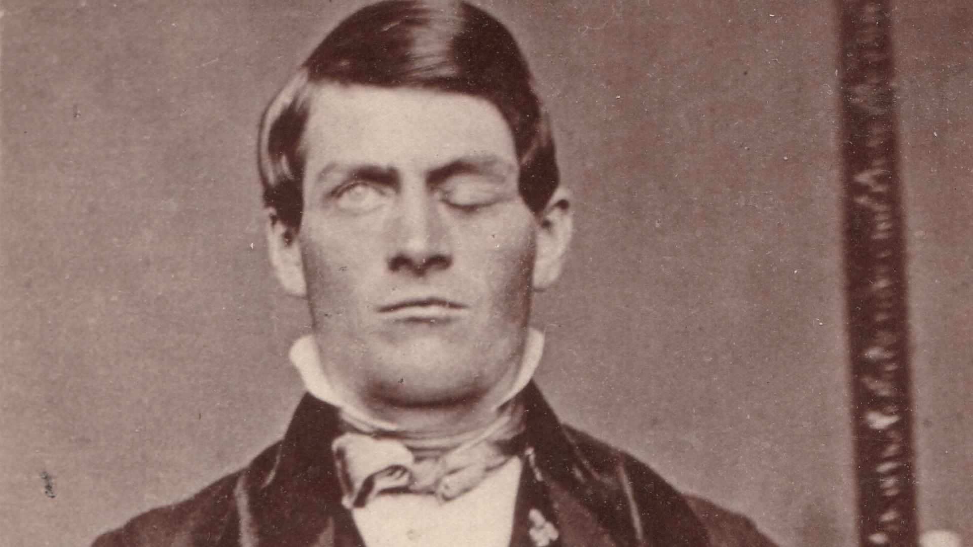 Cabinet-card portrait of brain-injury survivor Phineas P. Gage (1823–1860), shown holding the tamping iron which injured him; image cropped to remove much of surrounding card. From the Gage family of Texas photo collection. An identical image is in the po