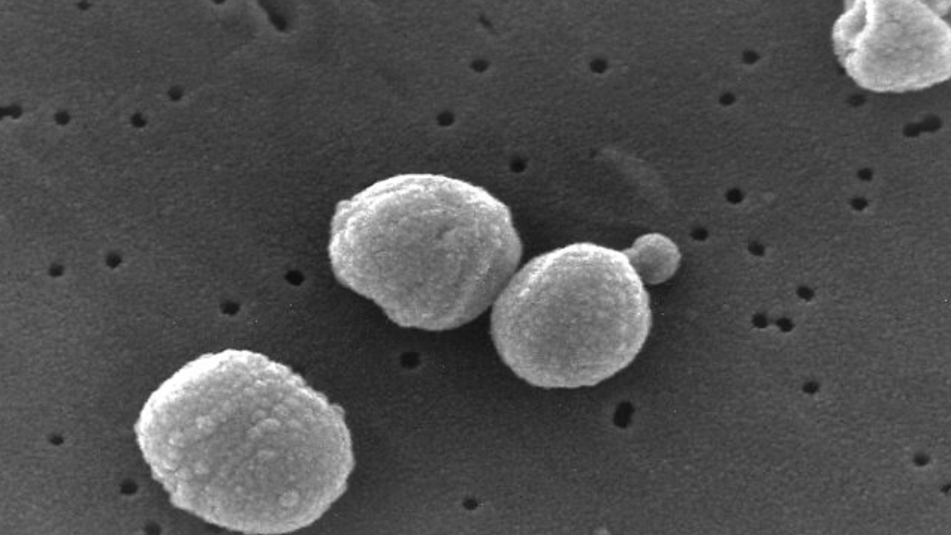 Scanning Electron Micrograph of Streptococcus pneumoniae. Pneumococcus, Streptococci